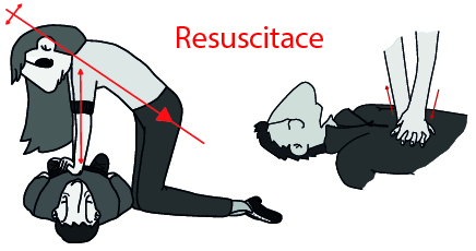 resuscitace-100.jpg